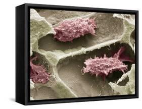 Osteoclasts In Bone Lacunae, SEM-Steve Gschmeissner-Framed Stretched Canvas