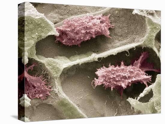 Osteoclasts In Bone Lacunae, SEM-Steve Gschmeissner-Stretched Canvas