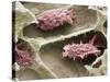 Osteoclasts In Bone Lacunae, SEM-Steve Gschmeissner-Stretched Canvas