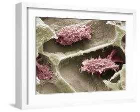 Osteoclasts In Bone Lacunae, SEM-Steve Gschmeissner-Framed Photographic Print