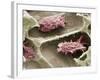 Osteoclasts In Bone Lacunae, SEM-Steve Gschmeissner-Framed Photographic Print