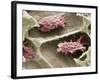 Osteoclasts In Bone Lacunae, SEM-Steve Gschmeissner-Framed Photographic Print