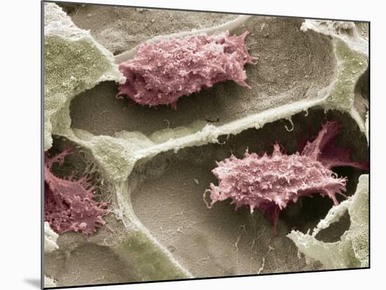 Osteoclasts In Bone Lacunae, SEM-Steve Gschmeissner-Mounted Photographic Print