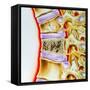 Osteoporitic Spine-John Bavosi-Framed Stretched Canvas