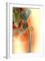 Osteoporosis of the Hip, X-ray-Science Photo Library-Framed Premium Photographic Print