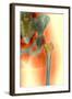 Osteoporosis of the Hip, X-ray-Science Photo Library-Framed Premium Photographic Print