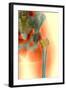 Osteoporosis of the Hip, X-ray-Science Photo Library-Framed Premium Photographic Print