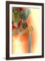 Osteoporosis of the Hip, X-ray-Science Photo Library-Framed Photographic Print