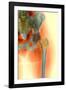 Osteoporosis of the Hip, X-ray-Science Photo Library-Framed Photographic Print