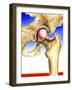 Osteoporosis-John Bavosi-Framed Photographic Print