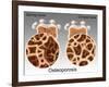 Osteoporotic & Normal Bone-Gwen Shockey-Framed Giclee Print