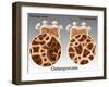 Osteoporotic & Normal Bone-Gwen Shockey-Framed Giclee Print