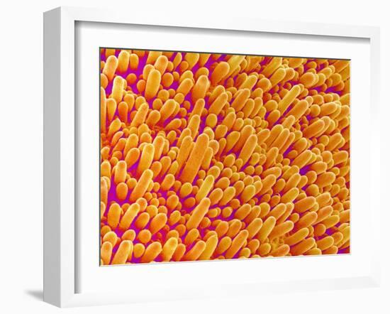 Outer Cells on Petal of Cymbidium Plant-Micro Discovery-Framed Premium Photographic Print