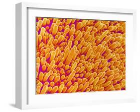 Outer Cells on Petal of Cymbidium Plant-Micro Discovery-Framed Premium Photographic Print