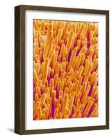 Outer Cells on Petal of Cymbidium Plant-Micro Discovery-Framed Photographic Print