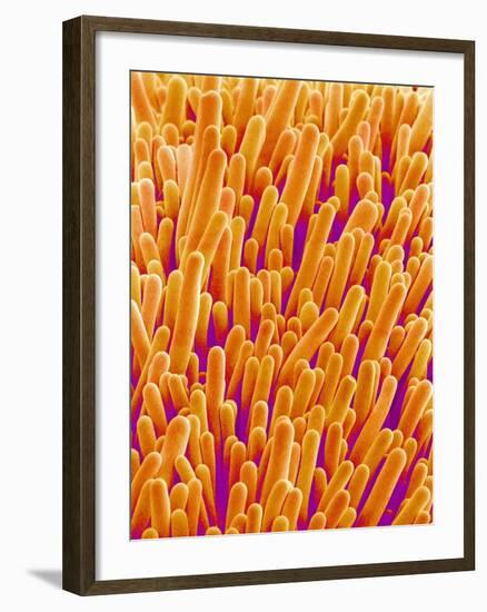 Outer Cells on Petal of Cymbidium Plant-Micro Discovery-Framed Photographic Print