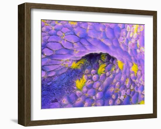 Ovarian Cancer Cells-P.m. Motta-Framed Photographic Print