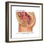 Overflow Incontinence in Female Anatomy-Gwen Shockey-Framed Art Print