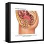 Overflow Incontinence in Female Anatomy-Gwen Shockey-Framed Stretched Canvas