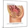 Overflow Incontinence in Female Anatomy-Gwen Shockey-Mounted Art Print