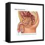 Overflow Incontinence in Male Anatomy-Gwen Shockey-Framed Stretched Canvas