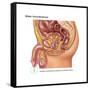 Overflow Incontinence in Male Anatomy-Gwen Shockey-Framed Stretched Canvas
