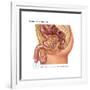 Overflow Incontinence in Male Anatomy-Gwen Shockey-Framed Art Print