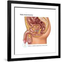 Overflow Incontinence in Male Anatomy-Gwen Shockey-Framed Art Print