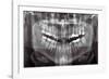 Panoramic Dental X-ray-null-Framed Photographic Print