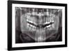 Panoramic Dental X-ray-null-Framed Photographic Print