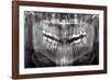 Panoramic Dental X-ray-null-Framed Photographic Print