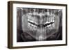 Panoramic Dental X-ray-null-Framed Photographic Print