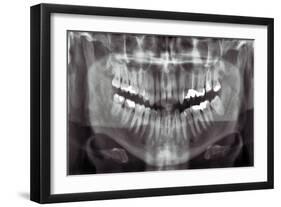 Panoramic Dental X-ray-null-Framed Photographic Print