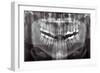 Panoramic Dental X-ray-null-Framed Photographic Print