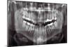 Panoramic Dental X-ray-null-Mounted Photographic Print