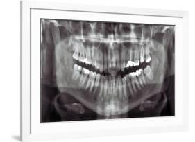 Panoramic Dental X-ray-null-Framed Photographic Print