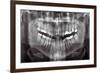Panoramic Dental X-ray-null-Framed Photographic Print