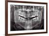 Panoramic Dental X-ray-null-Framed Photographic Print