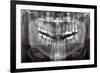 Panoramic Dental X-ray-null-Framed Photographic Print