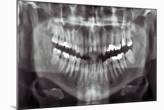 Panoramic Dental X-ray-null-Mounted Photographic Print