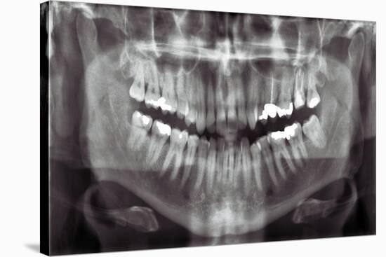 Panoramic Dental X-ray-null-Stretched Canvas