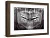 Panoramic Dental X-ray-null-Framed Photographic Print