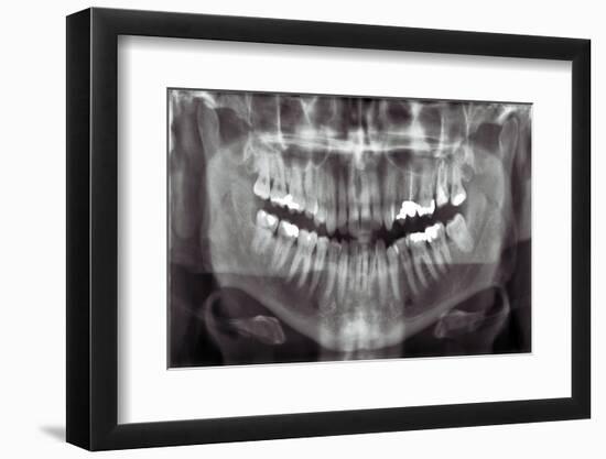 Panoramic Dental X-ray-null-Framed Photographic Print