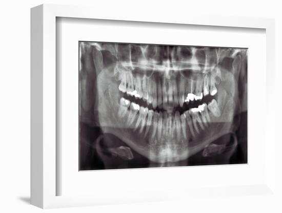 Panoramic Dental X-ray-null-Framed Photographic Print