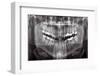 Panoramic Dental X-ray-null-Framed Photographic Print