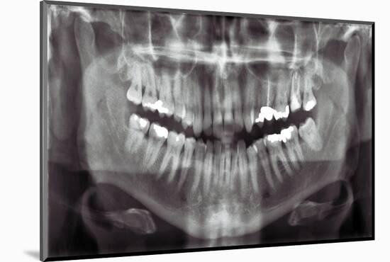 Panoramic Dental X-ray-null-Mounted Photographic Print