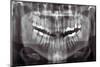 Panoramic Dental X-ray-null-Mounted Photographic Print