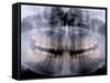 Panoramic X-Ray of Mouth-null-Framed Stretched Canvas