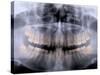 Panoramic X-Ray of Mouth-null-Stretched Canvas