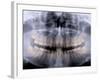 Panoramic X-Ray of Mouth-null-Framed Photographic Print